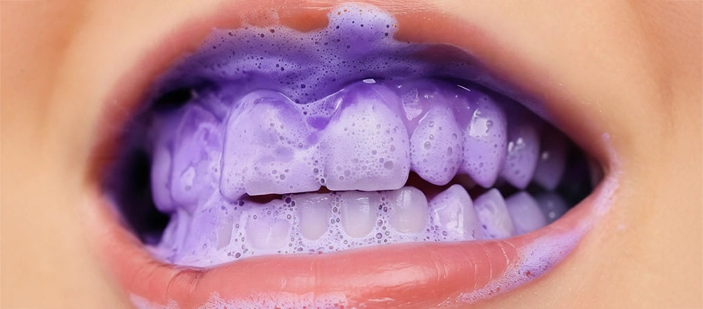 whitening-stipe