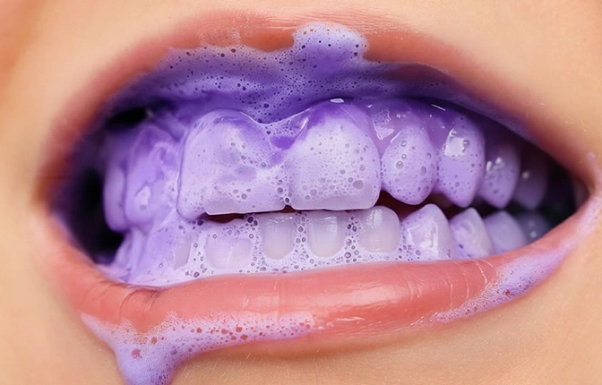 whitening-stipe