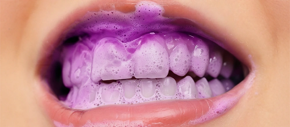 whitening-stipe