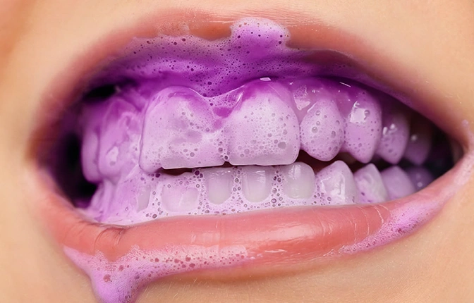 whitening-stipe